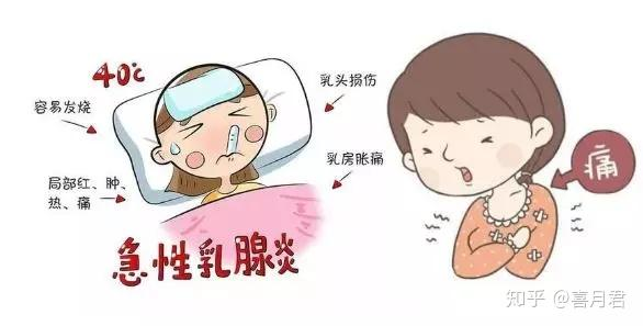 乳腺炎反復發(fā)作？這6個方法很管用