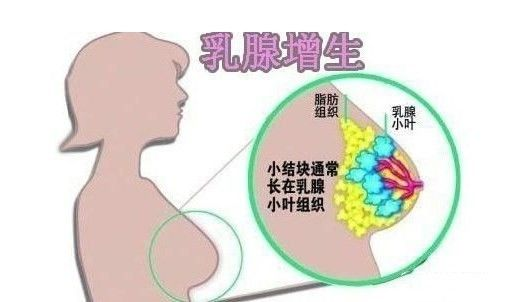 乳房出現(xiàn)“青筋”是什么原因呢？