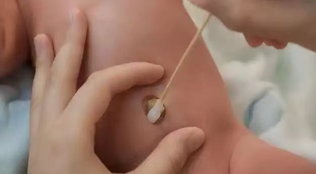  肚臍眼里的污垢，到底能不能摳？ 