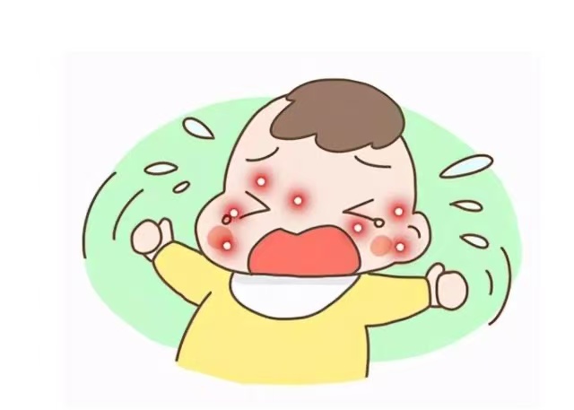 孩子濕疹反復(fù)發(fā)作怎么辦？這些防治方法請(qǐng)收好！